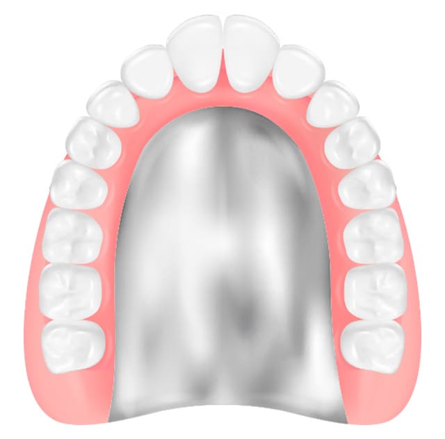 チタン床義歯
